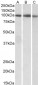 STAT5A Antibody (C-Term)